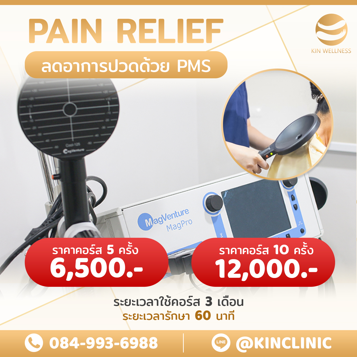 PMS โรคหลอดเลือดสมอง (stroke)